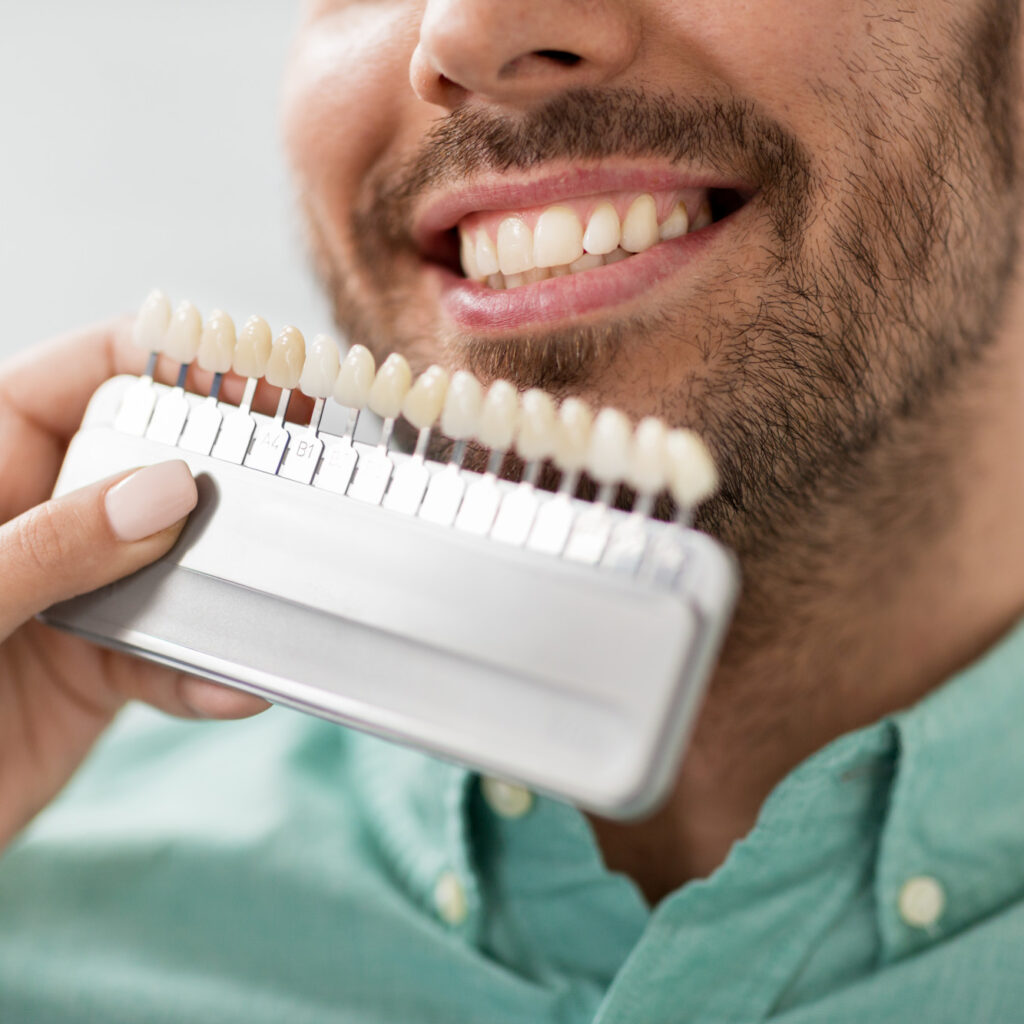 dentist choosing tooth color for patient at clinic